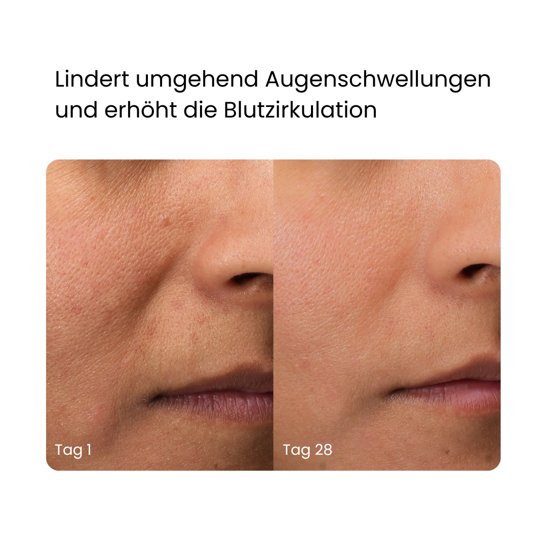 SKINMAX Gesichtsreiniger - Reinigen, Straffen und Regenieren