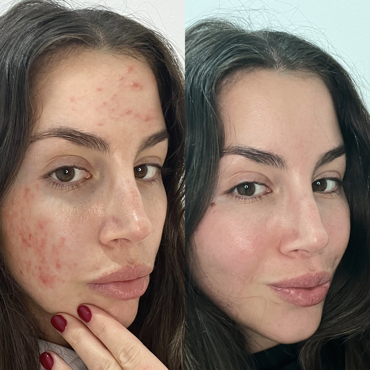 SKINMAX Gesichtsreiniger - Reinigen, Straffen und Regenieren