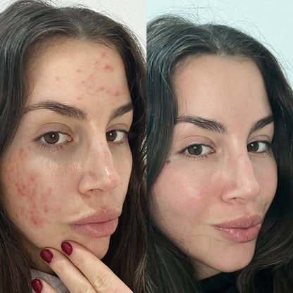 SKINMAX Gesichtsreiniger - Reinigen, Straffen und Regenieren