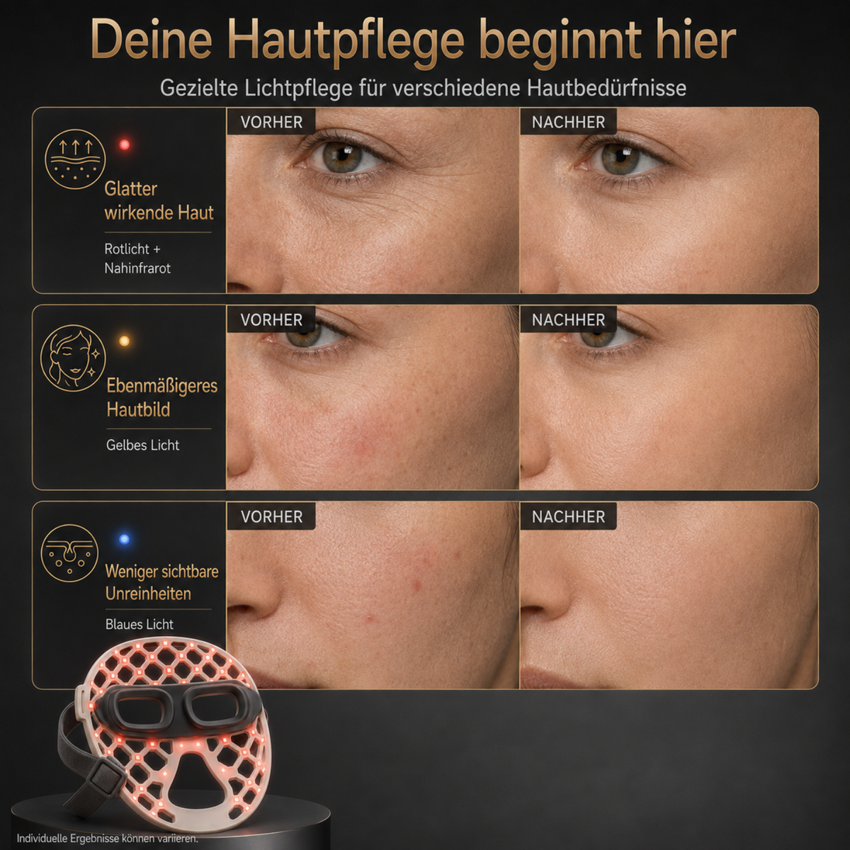 HOVAYA GLOWSKIN™ LED-Gesichtsmaske