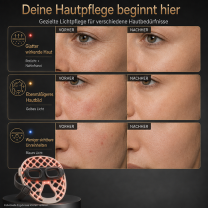 HOVAYA GLOWSKIN™ LED-Gesichtsmaske