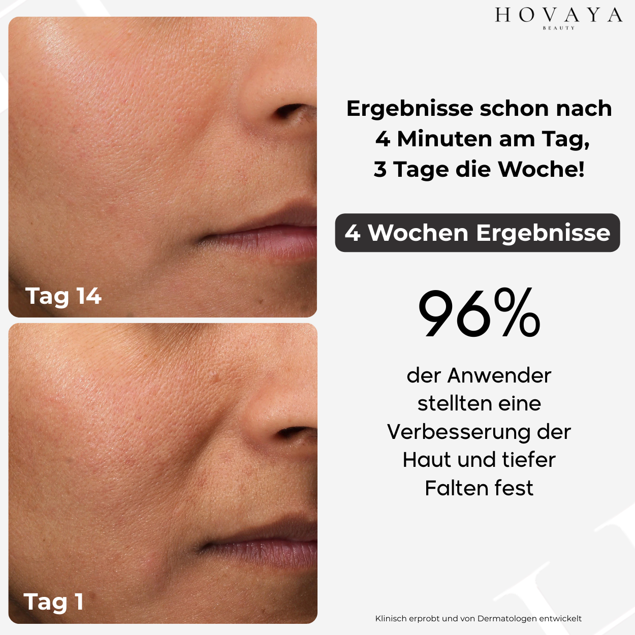 SKINREFINE Gesichtsmassagegerät