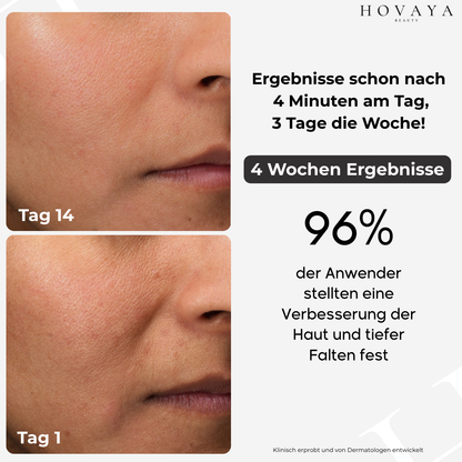 SKINREFINE Gesichtsmassagegerät